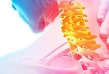 whiplash-and-soft-tissue-injuries-in-a-baltimore-car-accident